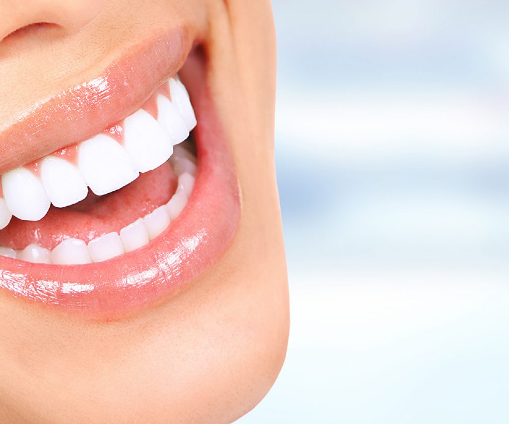 Periodontia implantes dentários